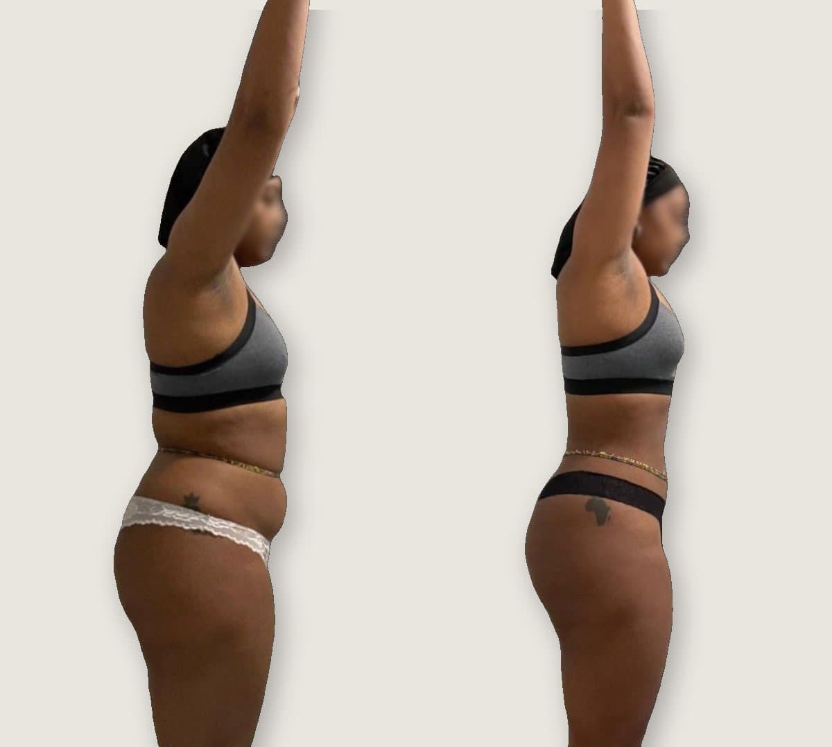Client 10: before on the left, after on the right